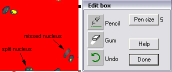 edit nuclei
